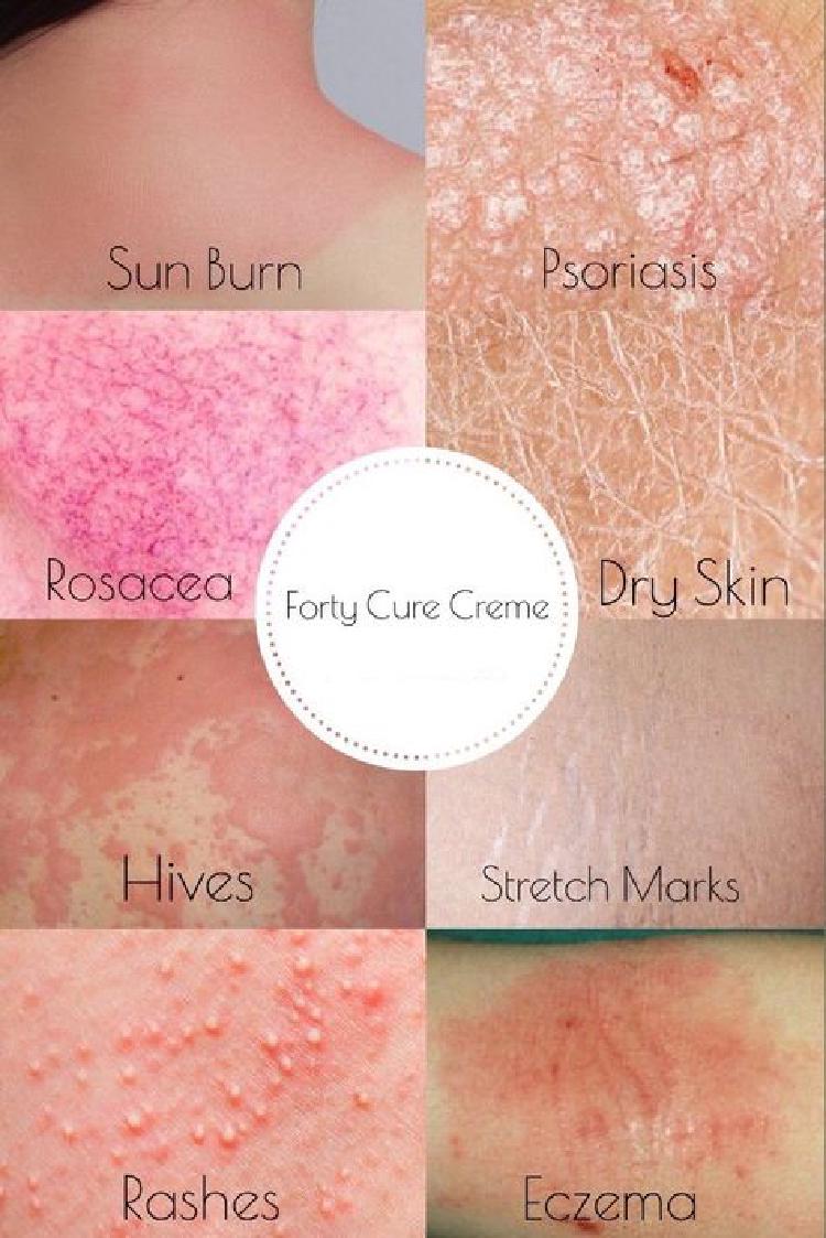 The Science of Skin: How AI Identifies Skin Issues