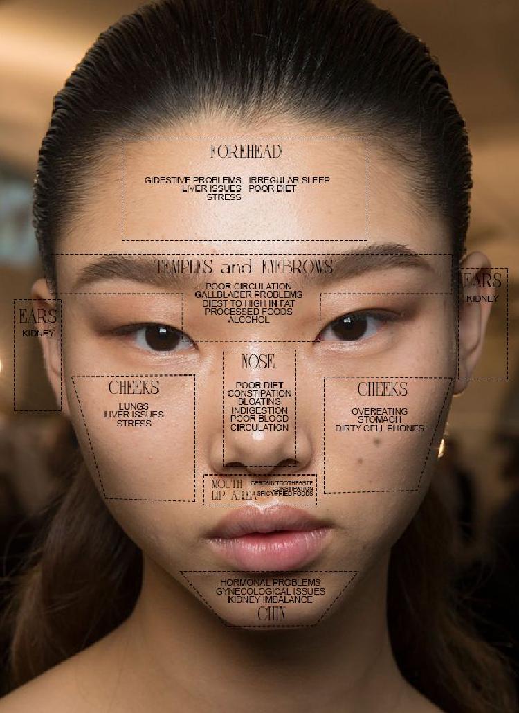 AI for Acne Treatment: A Customized Approach