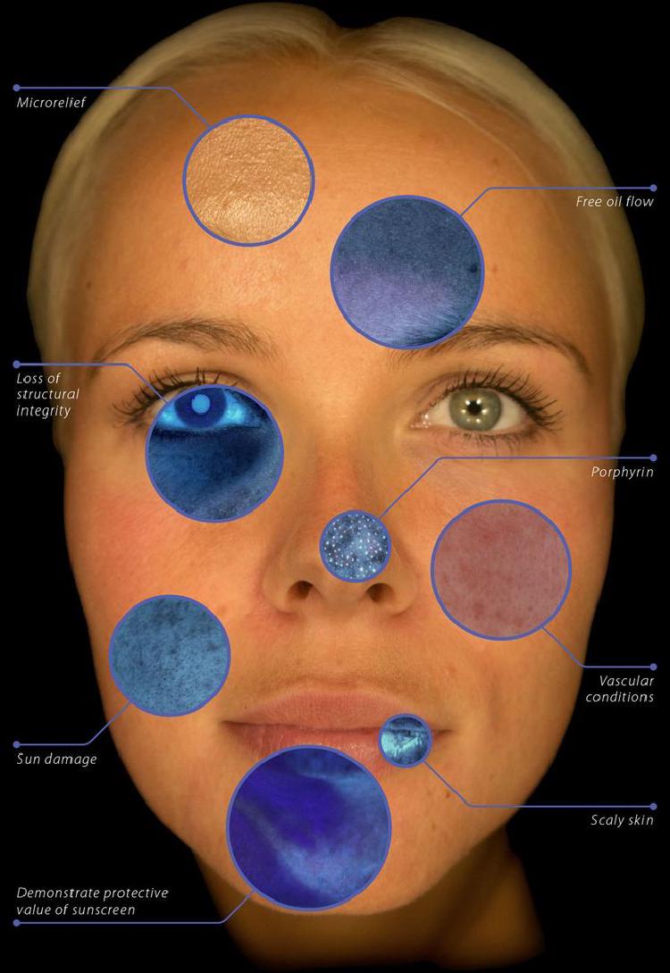 Understanding AI-Powered Skincare Analysis: How It Works
